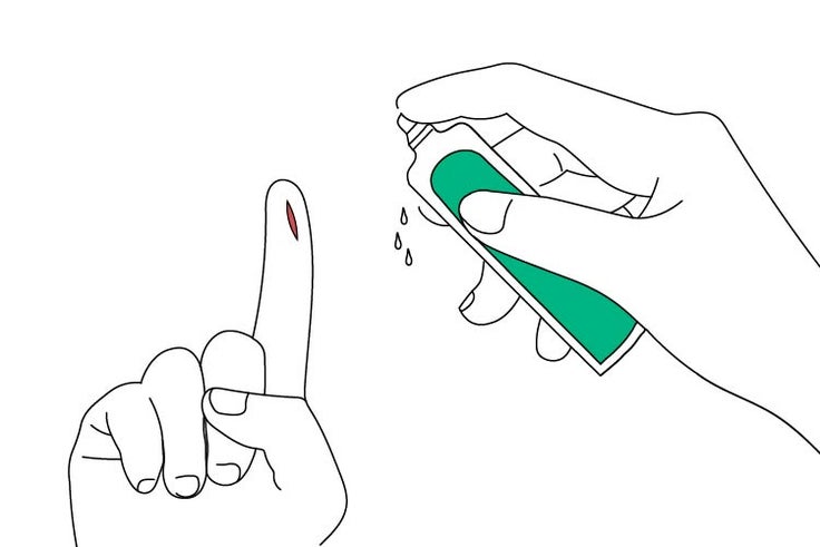 EZ6_Prontosan_Illustrationen