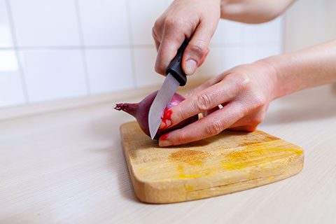 A woman cuts herself with a knife in the kitchen
