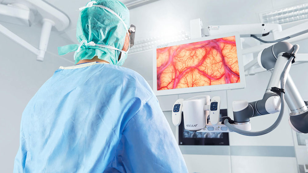 Kirurgi suorittaa leikkausta Aesculap Aeos® -leikkausmikroskoopilla seisoen suorassa ja katsoen näyttöä. 